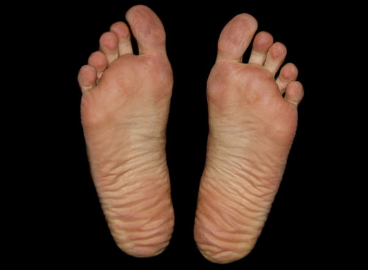 From Heel to Toe: Can Plantar Fasciitis Really Torment Your Toes Too?