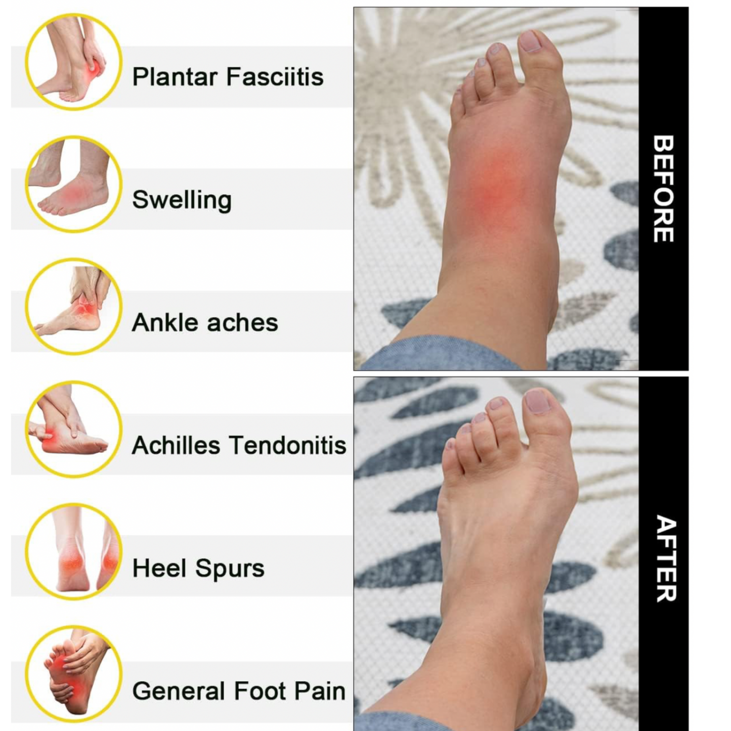 Healing Therapy socks (Grey Feet Design)