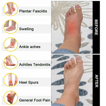 Healing Therapy socks (Grey and white  Foot)